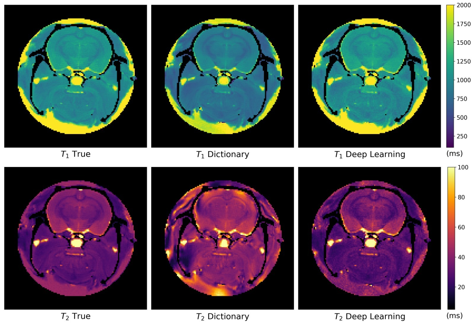 intelligenza artificiale risonanza